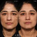 pigmentation 18.webp