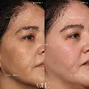 pigmentation 4.webp