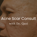 Acne Scar Consultation with Dr. Qazi (20 Minutes)