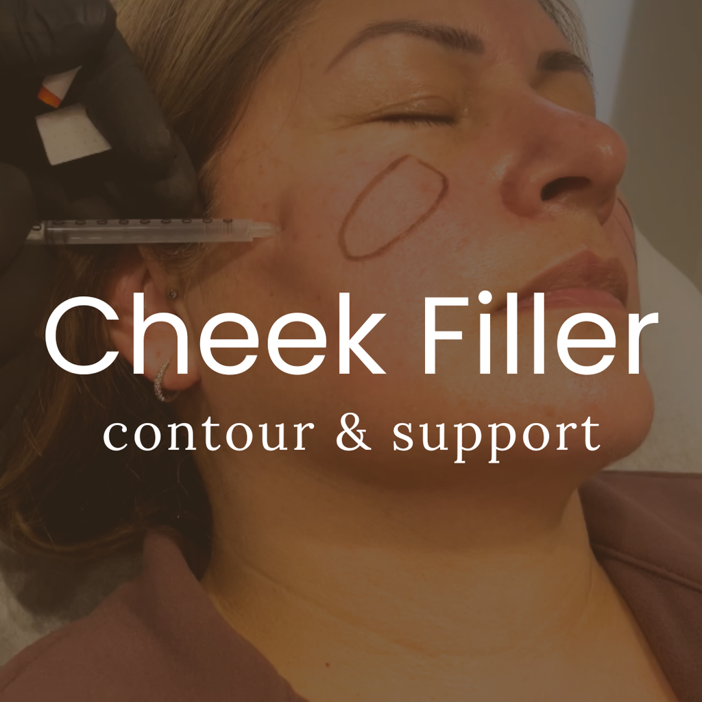 Cheek Enhancement Filler Treatment