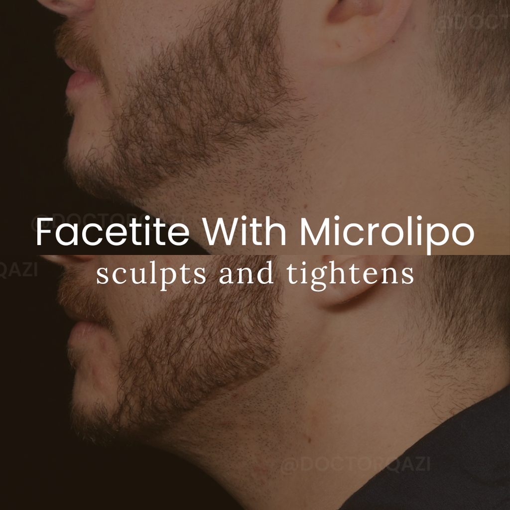 Facetite w/ Microlipo - Face + Neck