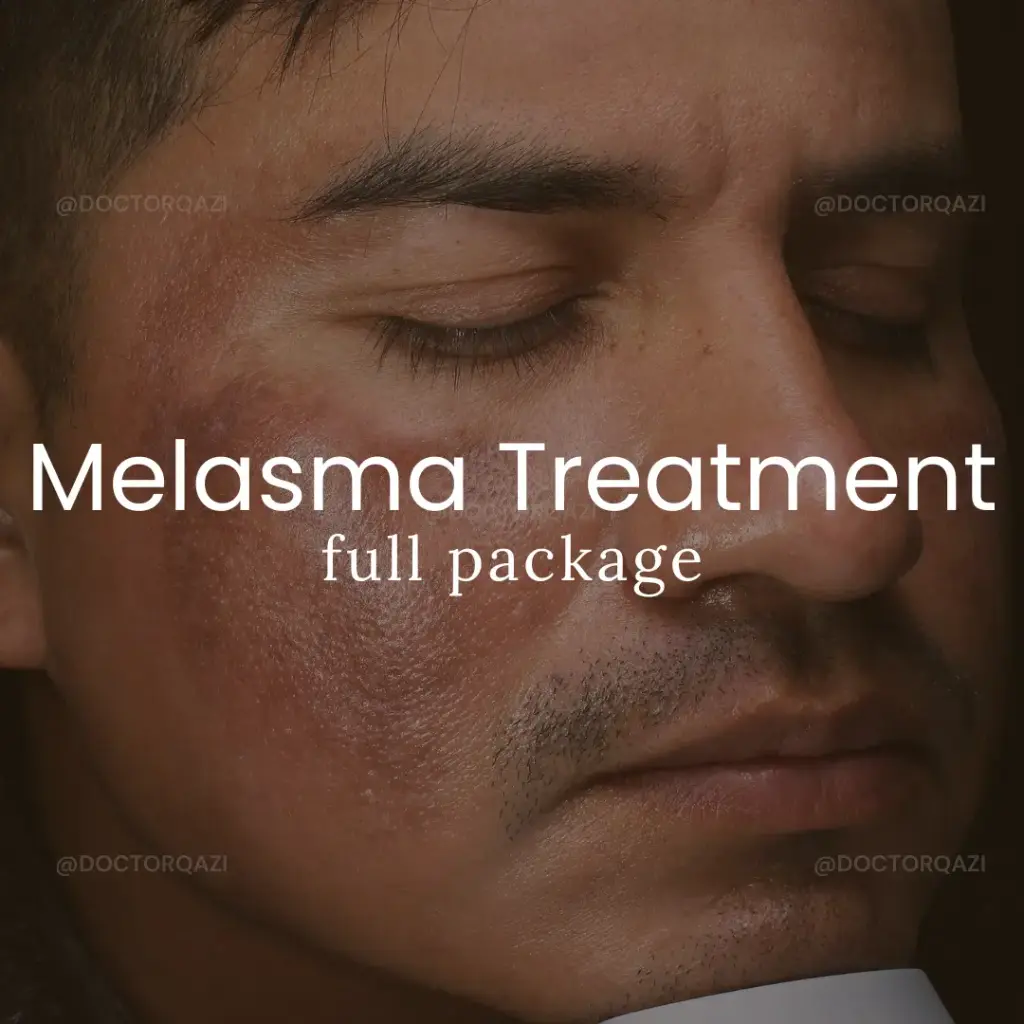 Melasma Treatment Package