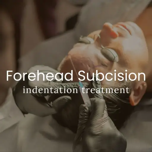 Forehead Subcision