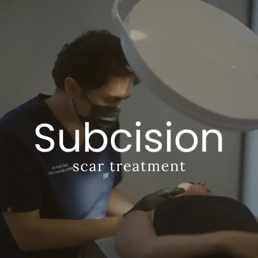Tumescent Subcision for Scars