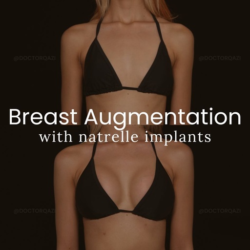 Breast Augmentation with Natrelle Implants