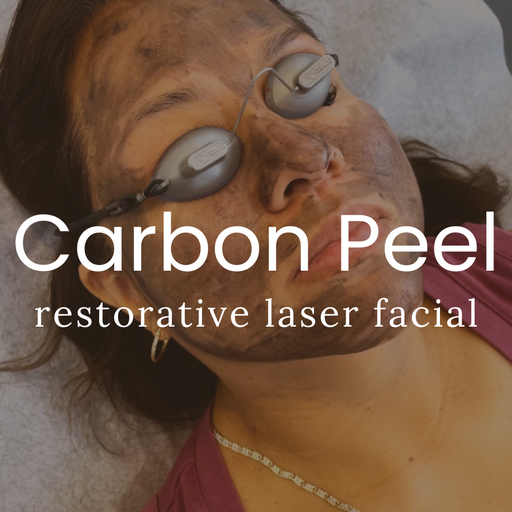 Carbon Laser Facial