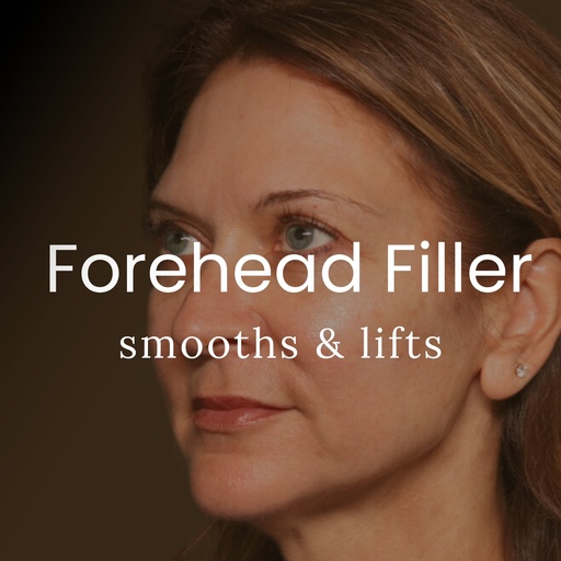 Forehead Filler Treatment