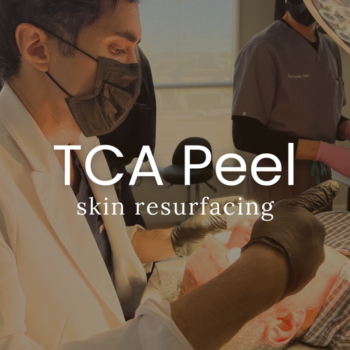 TCA Peel